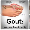 Relieve Gout with this Amazing All-Natural Treatment