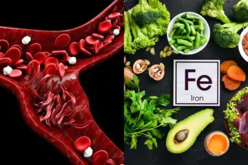 3 Beneficial Ways to Fight Off Iron Deficiency Naturally + Major Symptoms