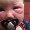 This Mother Warns all Parents about the Dangers of Aerosol Sunscreens