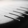 Acupuncture may Replace Antidepressants, Researchers Claim