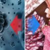 Scientists Found a Link between Poor Diet & Cancer