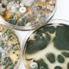 This Woman Was Bedridden for 35 Years due to Toxic Black Mold