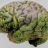 Cannabis may Better Memory in Alzheimer’s by Removing Alzheimer Proteins from the Brain