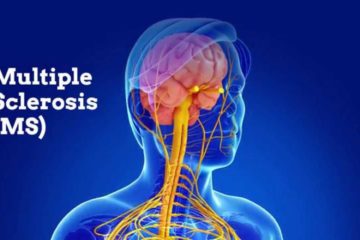 Alleviate Multiple Sclerosis Symptoms with these 5 Natural Remedies