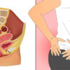 Anal Cancer: Major Indicating Signs