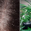 DIY Anti-Dandruff Shampoo Made with Amazing Essential Oils