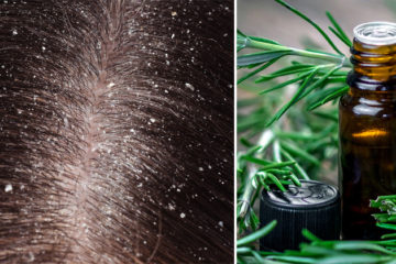 DIY Anti-Dandruff Shampoo Made with Amazing Essential Oils