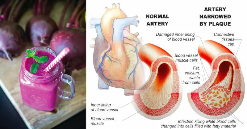 lower-your-blood-pressure-help-improve-blood-vessel-function-with