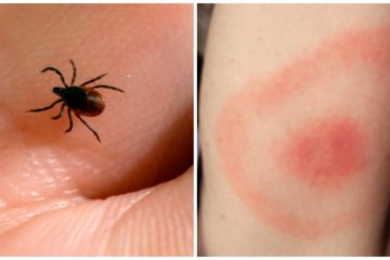 Oh, No: Illness Found that Is Transmitted by a Tick Species