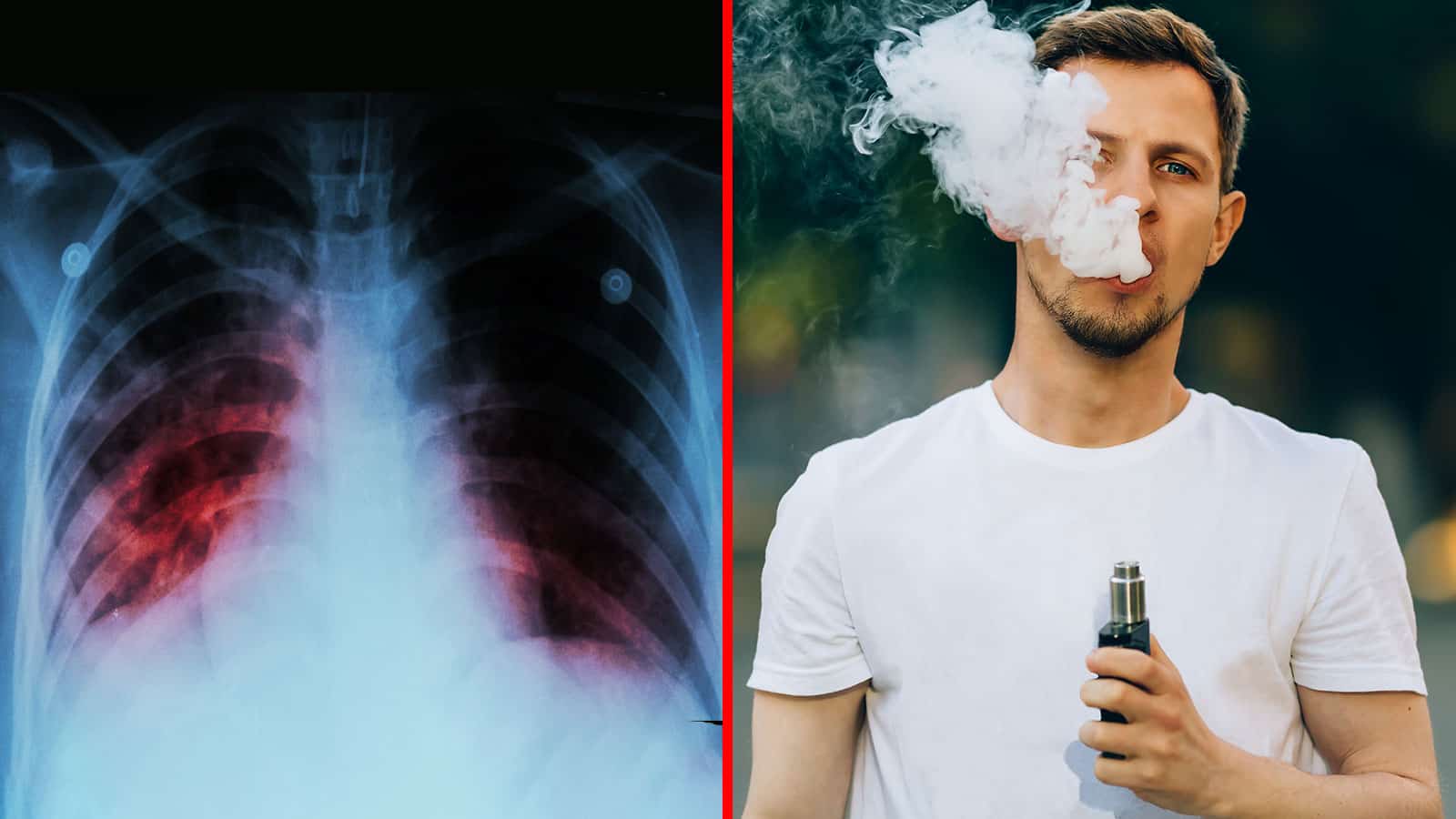 CDC Warns against Vaping after Spike in Lung Disease