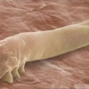 You Have Mites on Your Eyelashes & You Don’t even Know It, Scientists Say