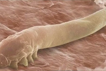 You Have Mites on Your Eyelashes & You Don’t even Know It, Scientists Say