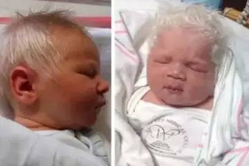 The Cute Baby Born with Gray Hair Takes over the Internet