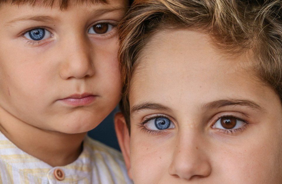 Brothers Born with Differently Coloured Eyes Each One Has One Blue