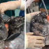 Shocking Images Show the Black Lungs of 52-Year-Old Smoker Who Smoked a Pack Daily for 30 Years