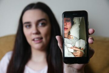 21-Year-Old Mother almost Dies from Stroke Weeks after Birth Due to the Placenta slowly Poisoning Her