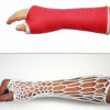 Innovative Engineering: Experts Make a Breathable & Waterproof Cast that can Replace Plaster Ones