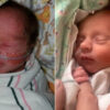 Indiana Mother Gives Birth to Twins in Different Decades