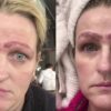 Oh, No: This Woman’s Microblading Procedure Resulted in Her Having 4 Eyebrows