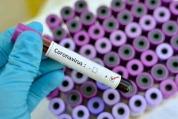 Is a Coronavirus Pandemic on Our Doorstep?