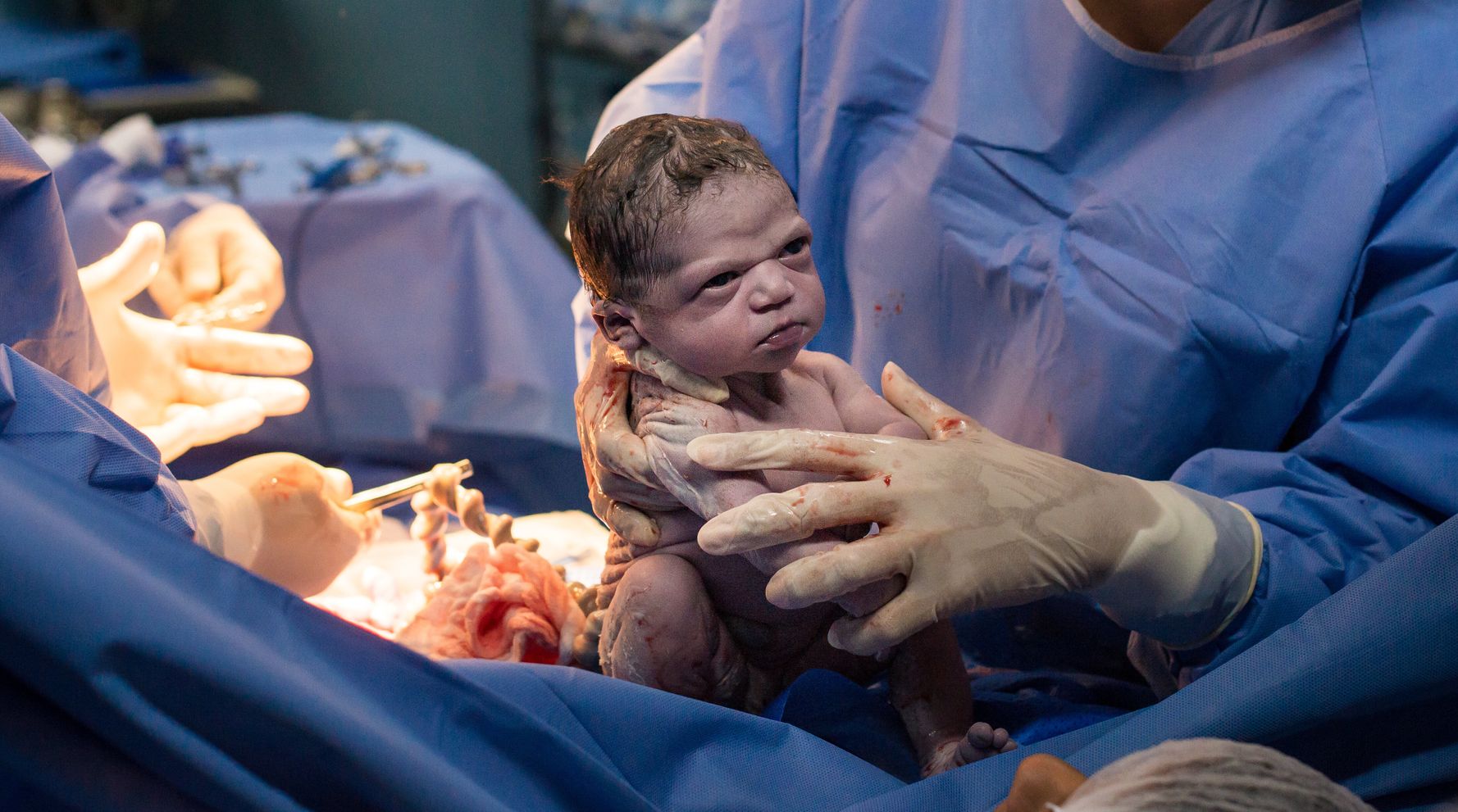 Baby Face Development After Birth