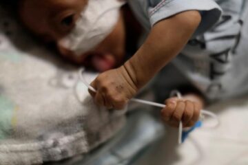 In North of Argentina, Indigenous Children Are Dying of Hunger
