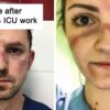 Heartbreaking Pics of Overworked Doctors Are Going Viral Proving that They too Have Human Limits