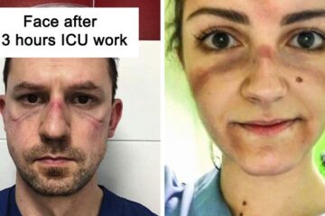 Heartbreaking Pics of Overworked Doctors Are Going Viral Proving that They too Have Human Limits