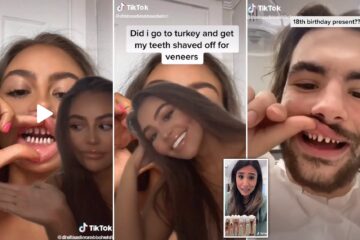 Young Influencers Filling Down their Teeth for Perfect Smile’: Dentists Warn They’ll Need Dentures by the Age of 40