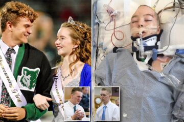 This Young Girl, 2 Years after Being Shot in the Head, Walked Proudly as the Homecoming Queen