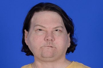 This 22-Year-Old Is the First in the World to Undergo a Face & Hand Transplant