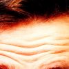 Research Finds a Link between Deep Forehead Wrinkles & Heart Illness