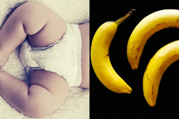 For the First Time ever: A Baby Born with 3 Penises