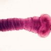 How Mind-Eating Parasites from Cat Poop Are Making a Global Intelligence Gap