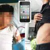 Remember the Teen Who Sold His Kidney for an iPhone?-He’s Bedridden for Life