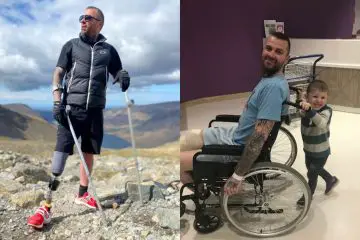 Amputee Who can Walk for 20 Minutes at a Time Climbs the Three Highest Peaks in England