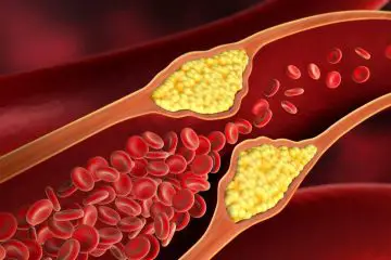 Top 10 Spices & Herbs to Unclog Your Arteries & Prevent a Heart Attack