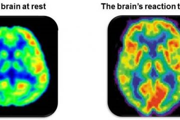 Are You One of Them? – Deeply Empathic People Process Music differently