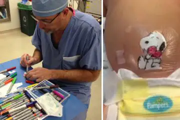 Surgeon Surprises Kids with Hand-Drawn Dressings of their Scars so that They Won’t Be the Last Memory of the Surgery