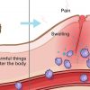 10 Warning Symptoms of Hidden Inflammation in the Body + Tips to Get Rid of It
