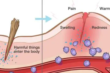 10 Warning Symptoms of Hidden Inflammation in the Body + Tips to Get Rid of It