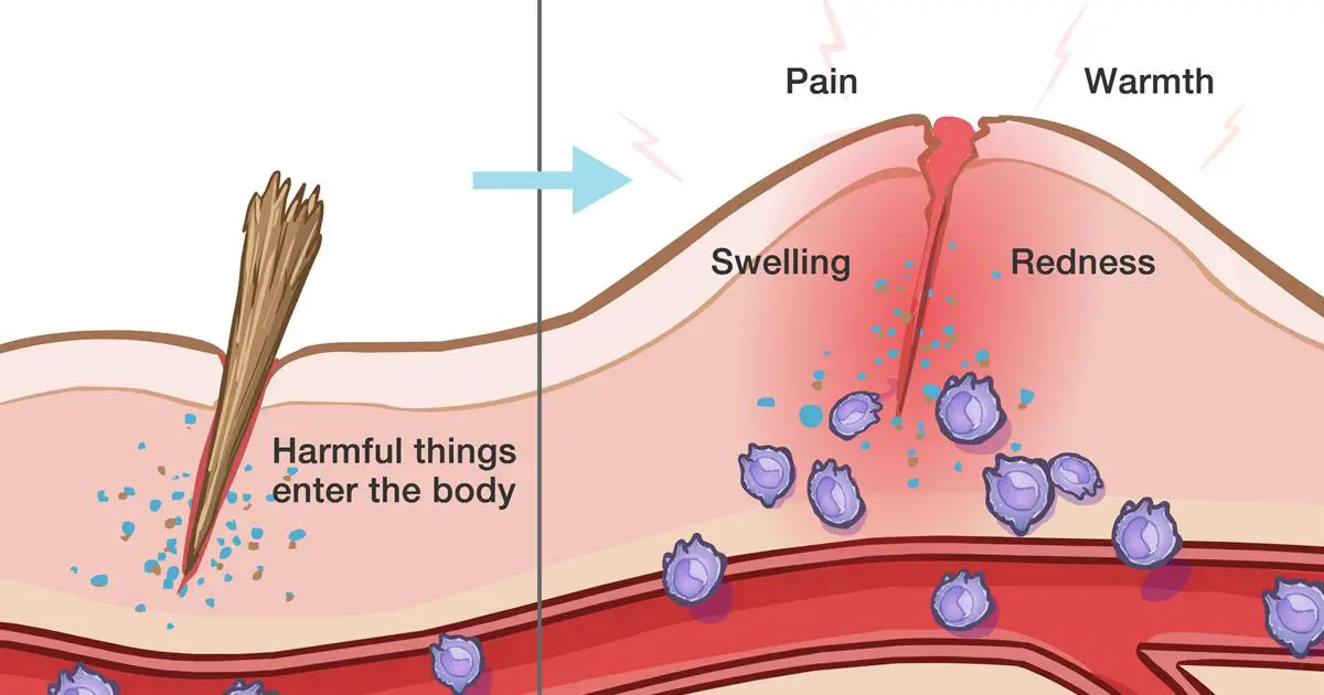 10-warning-symptoms-of-hidden-inflammation-in-the-body-tips-to-get