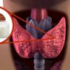 This Is How Coconut Oil Supports Your Thyroid Health
