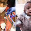 World’s Most Premature Baby Defies 1 Percent Survival Odds & Breaks the Guinness Record