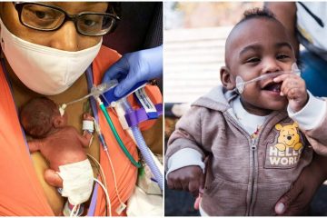 World’s Most Premature Baby Defies 1 Percent Survival Odds & Breaks the Guinness Record