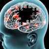 Innovative & Promising Method for Treatment of Alzheimer’s Developed by Researchers