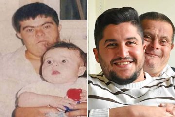 Dad with Down Syndrome Raises a Son Who Became a Dentist & They’re a Proof of Pure Love