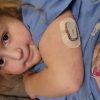 Artificial Pancreas Revolutionizing Diabetes Treatment: “I Never Dream This Would Be Developed in my Lifetime”