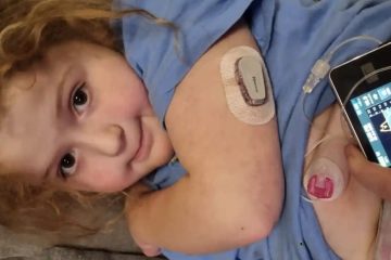 Artificial Pancreas Revolutionizing Diabetes Treatment: “I Never Dream This Would Be Developed in my Lifetime”