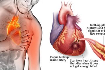 80% of Heart Attacks Could Be Avoided by Doing These 5 Easy Things